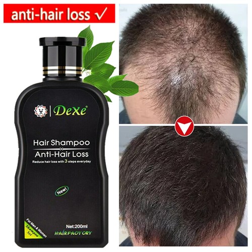 Hair growth shampoo - hair,