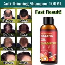 DHT Support Shampoo 100ml –