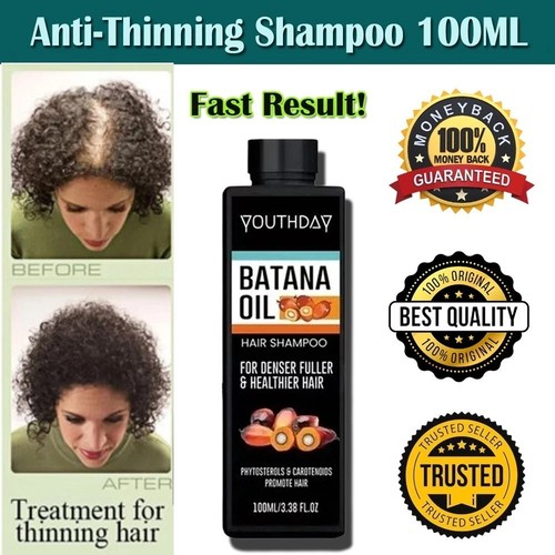 Dht blocker hair loss - blocker,