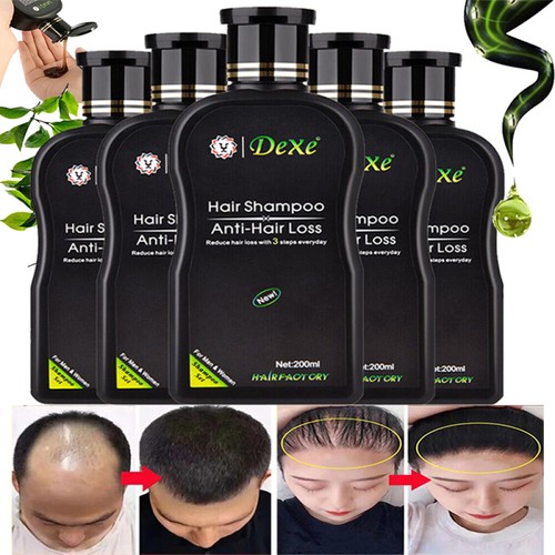 200ml dexe fast hair - 200ml, growth