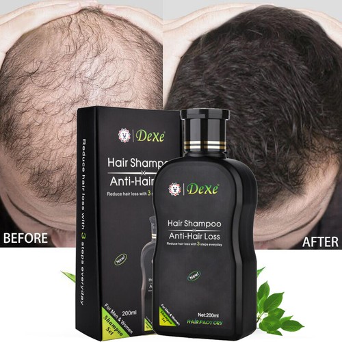 200ml dexe fast hair growth - 200ml,