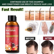 DHT Blocker Hair Loss Shampoo