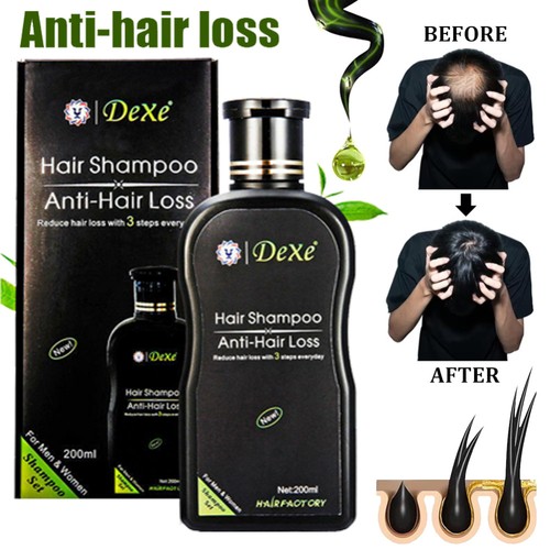 Dexe hair growth - growth, shampoo